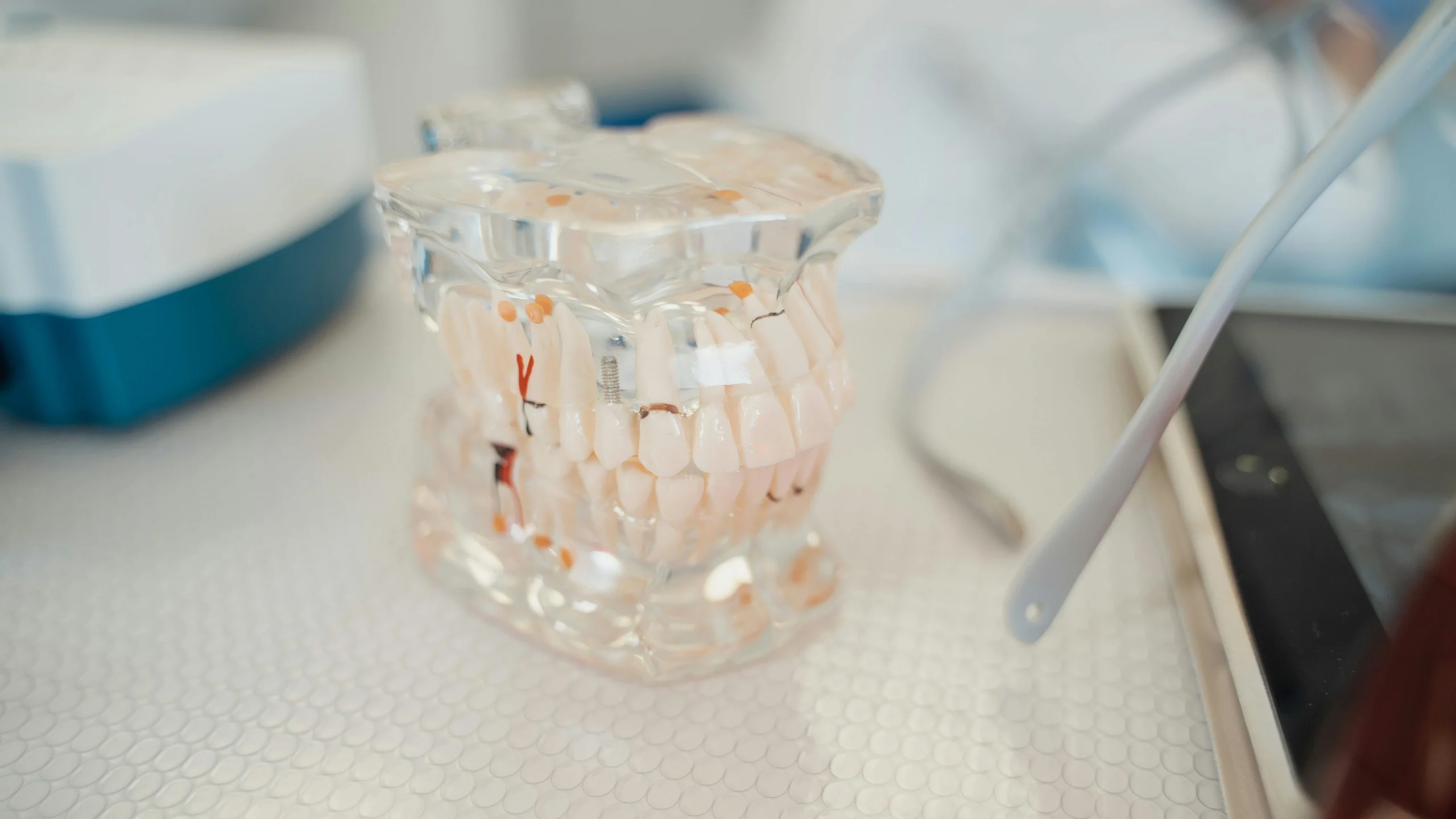 Advanced Dental Implant Technology for Perfect Smiles