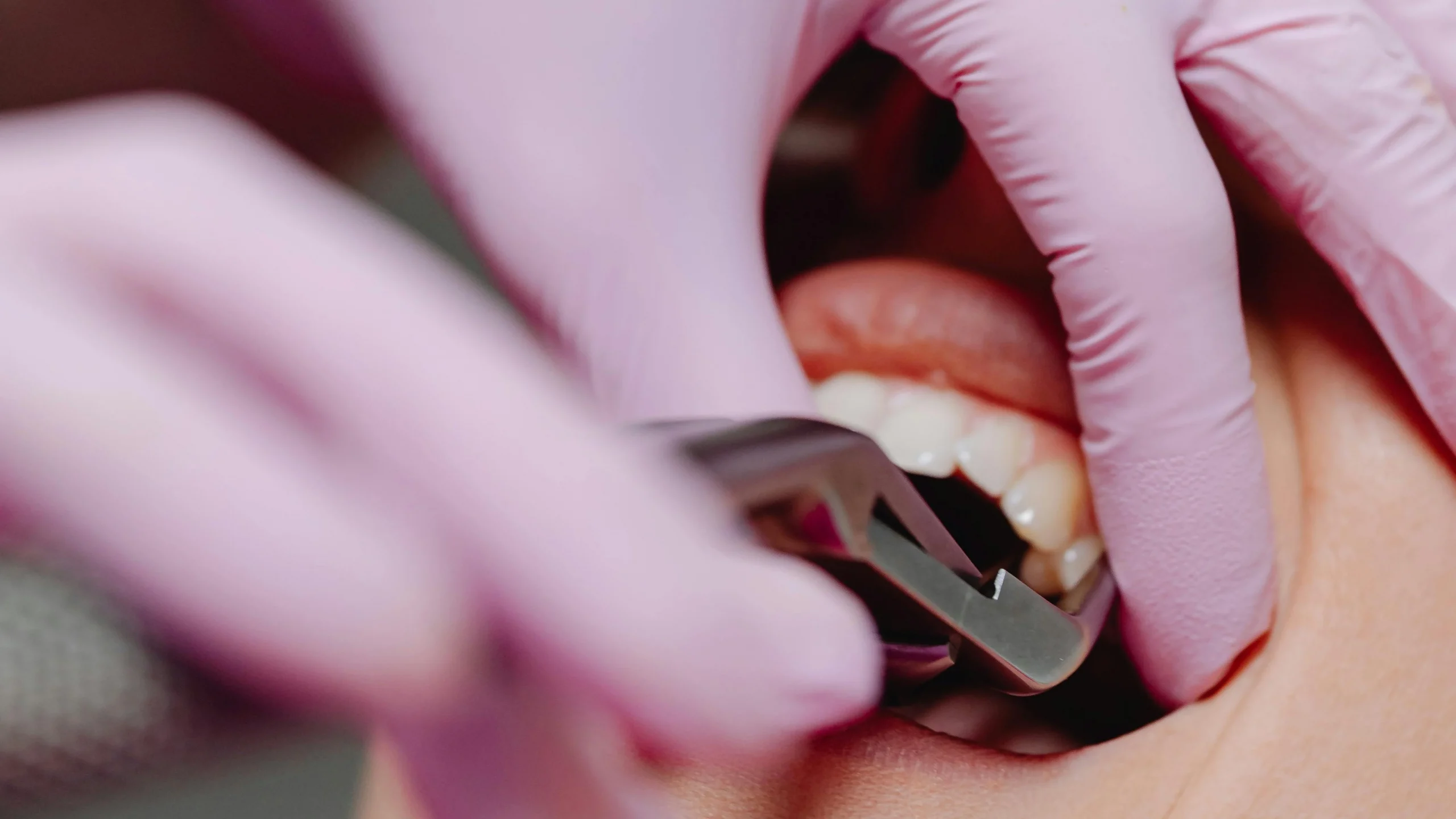 Obedoza Cosmetic Dentistry Service Obedoza Cosmetic Destistry