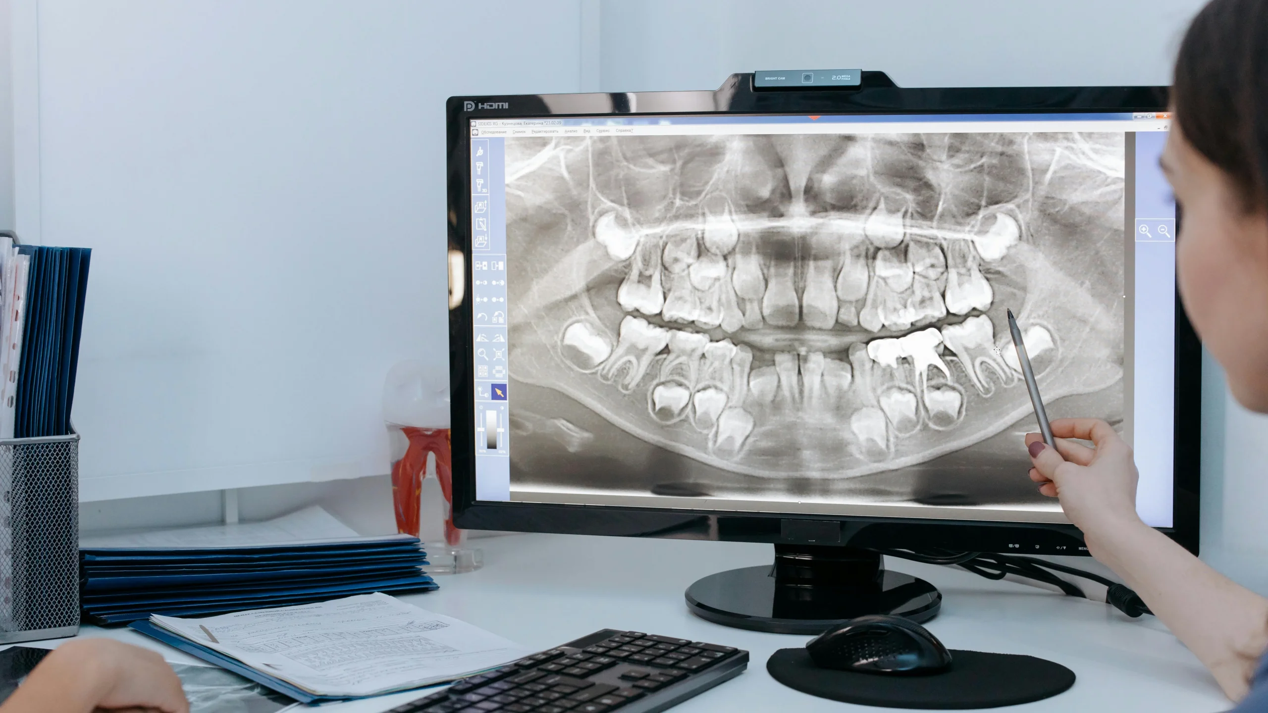 Obedoza Dental X-Ray