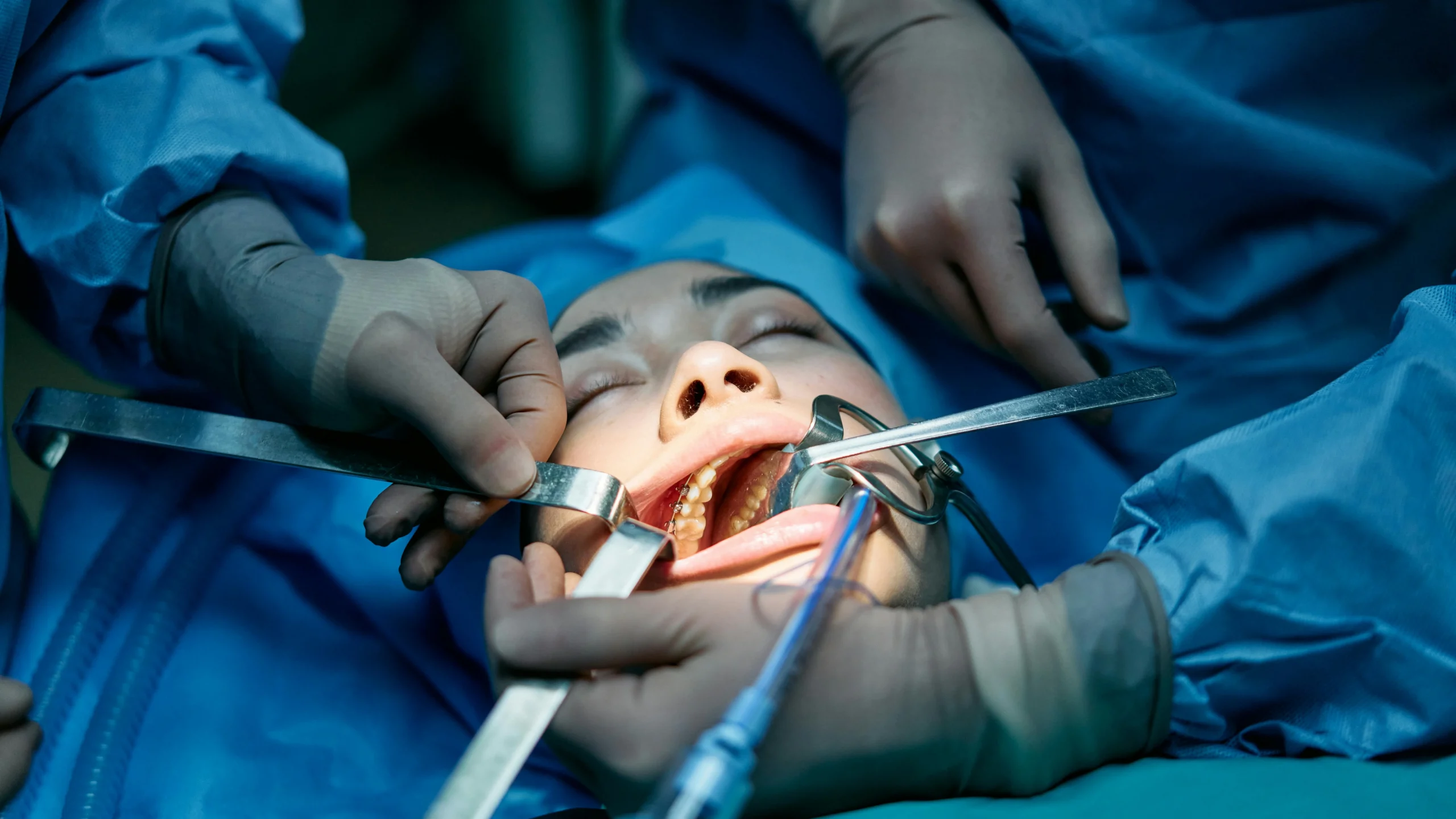 The Importance of Trusting Professional Dentists for Oral Surgery
